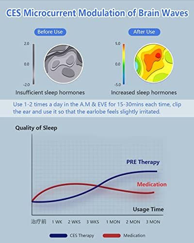 1710538549 830 KTS 20 CES dispositivo de terapia de insomnio con estimulacion