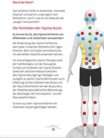 1711041430 87 Hijama Hacamat Ventosas terapia